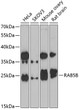 Western blot analysis of extracts of various cell lines, using RAB5B antibody (STJ29583) at 1:1000 dilution. _Secondary antibody: HRP Goat Anti-Rabbit IgG (H+L) (STJS000856) at 1:10000 dilution. _Lysates/proteins: 25 Mu g per lane. _Blocking buffer: 3% nonfat dry milk in TBST. _Detection: ECL Enhanced Kit. _Exposure time: 90s.