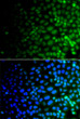 Immunofluorescence analysis of A549 cells using ULK4 antibody (STJ29607). Blue: DAPI for nuclear staining.