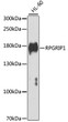 Western blot analysis of lysates from HL-60 cells, using RPGRIP1 Rabbit pAb (STJ29613) at 1:1000 dilution. <br/>Secondary antibody: HRP-conjugated Goat anti-Rabbit IgG (H+L) (STJS000856) at 1:10000 dilution. <br/>Lysates/proteins: 25 Mu g per lane. <br/>Blocking buffer: 3% nonfat dry milk in TBST. <br/>Detection: ECL Enhanced Kit <br/>Exposure time: 30s.