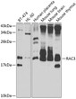 Western blot analysis of extracts of various cell lines, using RAC3 antibody (STJ29634) at 1:1000 dilution. Secondary antibody: HRP Goat Anti-Rabbit IgG (H+L) (STJS000856) at 1:10000 dilution. Lysates/proteins: 25 Mu g per lane. Blocking buffer: 3% nonfat dry milk in TBST. Detection: ECL Enhanced Kit. Exposure time: 30s.