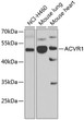 Western blot analysis of extracts of various cell lines, using ACVR1 antibody (STJ29680) at 1:1000 dilution. Secondary antibody: HRP Goat Anti-Rabbit IgG (H+L) (STJS000856) at 1:10000 dilution. Lysates/proteins: 25 Mu g per lane. Blocking buffer: 3% nonfat dry milk in TBST. Detection: ECL Enhanced Kit. Exposure time: 90s.
