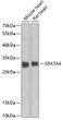 Western blot analysis of extracts of various cell lines, using SPATA4 antibody (STJ29745) at 1:1000 dilution. Secondary antibody: HRP Goat Anti-Rabbit IgG (H+L) (STJS000856) at 1:10000 dilution. Lysates/proteins: 25 Mu g per lane. Blocking buffer: 3% nonfat dry milk in TBST. Detection: ECL Basic Kit. Exposure time: 90s.