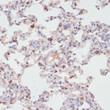 Immunohistochemistry analysis of PKC delta in paraffin-embedded rat lung using PKC delta Rabbit polyclonal antibody (STJ29804) at dilution of 1:100 (40x lens). Perform microwave antigen retrieval with 10 mM PBS buffer pH 7. 2 before commencing with immunohistochemistry staining protocol.