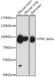 Western blot analysis of various lysates using PKC delta Rabbit polyclonal antibody (STJ29804) at 1:1000 dilution. Secondary antibody: HRP Goat Anti-Rabbit IgG (H+L) (STJS000856) at 1:10000 dilution. Lysates/proteins: 25 Mu g per lane. Blocking buffer: 3% nonfat dry milk in TBST. Detection: ECL Basic Kit. Exposure time: 1min.