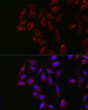 Immunofluorescence analysis of U2OS cells using YES1 Rabbit polyclonal antibody (STJ29810) at dilution of 1:200 (40x lens). Blue: DAPI for nuclear staining.
