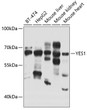 Western blot analysis of extracts of various cell lines, using YES1 antibody (STJ29810) at 1:1000 dilution. Secondary antibody: HRP Goat Anti-Rabbit IgG (H+L) (STJS000856) at 1:10000 dilution. Lysates/proteins: 25 Mu g per lane. Blocking buffer: 3% nonfat dry milk in TBST. Detection: ECL Basic Kit. Exposure time: 20s.