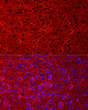 Perform microwave antigen retrieval with 10 mM citrate buffer pH 6. 0 before commencing with IF staining protocol. Immunofluorescence analysis of mouse brain cells using EAAT2/SLC1A2 rabbit polyclonal antibody (STJ29823) at dilution of 1:200 (40x lens). Blue: DAPI for nuclear staining.