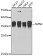 Western blot analysis of various lysates using SMN2 Rabbit polyclonal antibody (STJ29863) at 1:1000 dilution. Secondary antibody: HRP Goat Anti-Rabbit IgG (H+L) (STJS000856) at 1:10000 dilution. Lysates/proteins: 25 Mu g per lane. Blocking buffer: 3% nonfat dry milk in TBST. Detection: ECL Basic Kit. Exposure time: 30s.