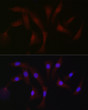 Immunofluorescence analysis of NIH/3T3 cells using PKC-beta Rabbit polyclonal antibody (STJ29922) at dilution of 1:50 (40x lens). Blue: DAPI for nuclear staining.