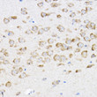 Immunohistochemistry analysis of paraffin-embedded mouse brain using RPL4 Rabbit polyclonal antibody (STJ29925) at dilution of 1:100 (40x lens). Perform high pressure antigen retrieval with 10 mM citrate buffer pH 6. 0 before commencing with immunohistochemistry staining protocol.