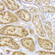 Immunohistochemistry analysis of paraffin-embedded rat kidney using RPL4 Rabbit polyclonal antibody (STJ29925) at dilution of 1:100 (40x lens). Perform high pressure antigen retrieval with 10 mM citrate buffer pH 6. 0 before commencing with immunohistochemistry staining protocol.