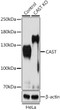 Western blot analysis of extracts from normal (control) and CAST knockout (KO) HeLa cells, using CAST antibody (STJ29949) at 1:1000 dilution. Secondary antibody: HRP Goat Anti-Rabbit IgG (H+L) (STJS000856) at 1:10000 dilution. Lysates/proteins: 25 Mu g per lane. Blocking buffer: 3% nonfat dry milk in TBST. Detection: ECL Basic Kit. Exposure time: 1s.