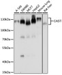 Western blot analysis of extracts of various cell lines, using CAST antibody (STJ29949) at 1:1000 dilution. Secondary antibody: HRP Goat Anti-Rabbit IgG (H+L) (STJS000856) at 1:10000 dilution. Lysates/proteins: 25 Mu g per lane. Blocking buffer: 3% nonfat dry milk in TBST. Detection: ECL Basic Kit. Exposure time: 5s.