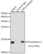 Immunoprecipitation analysis of 150 Mu g extracts of MCF7 cells using 3 Mu g Thioredoxin 1 (Trx1/Thioredoxin 1 (Trx1/TXN) ) antibody (STJ29953). Western blot was performed from the immunoprecipitate using Thioredoxin 1 (Trx1/Thioredoxin 1 (Trx1/TXN) ) antibody (STJ29953) at a dilution of 1:500.
