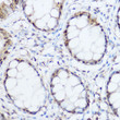 Immunohistochemistry analysis of Thioredoxin 1 (Trx1/TXN) in paraffin-embedded human colon using Thioredoxin 1 (Trx1/Thioredoxin 1 (Trx1/TXN) ) Rabbit polyclonal antibody (STJ29953) at dilution of 1:300 (40x lens). Perform high pressure antigen retrieval with 10 mM citrate buffer pH 6. 0 before commencing with immunohistochemistry staining protocol.
