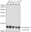 Western blot analysis of various lysates using Thioredoxin 1 (Trx1/TXN) Rabbit polyclonal antibody (STJ29953) at 1:1000 dilution. Secondary antibody: HRP Goat Anti-Rabbit IgG (H+L) (STJS000856) at 1:10000 dilution. Lysates/proteins: 25 Mu g per lane. Blocking buffer: 3% nonfat dry milk in TBST. Detection: ECL Basic Kit. Exposure time: 90s.