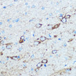 Immunohistochemistry analysis of paraffin-embedded rat brain using NMDAR1 rabbit polyclonal antibody (STJ29990) at dilution of 1:100 (40x lens). Perform microwave antigen retrieval with 10 mM PBS buffer pH 7. 2 before commencing with immunohistochemistry staining protocol.