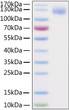 2019-nCoV Spike S1 protein (C-His&Avi) (STJP000022)