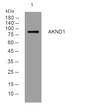 Western blot analysis of lysates from HuvEc cells, primary antibody was diluted at 1:1000, 4°C over night