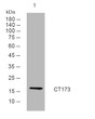 Western blot analysis of lysates from MCF-7 cells, primary antibody was diluted at 1:1000, 4°C over night