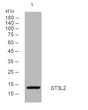 Western blot analysis of lysates from KB cells, primary antibody was diluted at 1:1000, 4°C over night