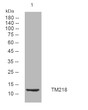 Western blot analysis of lysates from DU145 cells, primary antibody was diluted at 1:1000, 4°C over night Western blot analysis of lysates from DU145 cells, primary antibody was diluted at 1:1000, 4°C over night