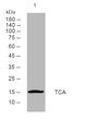 Western blot analysis of lysates from U2OS cells, primary antibody was diluted at 1:1000, 4°C over night Western blot analysis of lysates from U2OS cells, primary antibody was diluted at 1:1000, 4°C over night