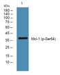 Western blot analysis of lysates from HCT116 cells, primary antibody was diluted at 1:1000, 4°C overnight STJ194721