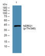 Western blot analysis of lysates from PC12 cells, primary antibody was diluted at 1:1000, 4°C over night
