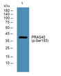 Western blot analysis of lysates from U2OS cells, primary antibody was diluted at 1:1000, 4° overnight STJ194735