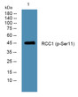 Western blot analysis of lysates from Jarkat cells, primary antibody was diluted at 1:1000, 4°C over night