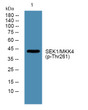 Western blot analysis of lysates from HCT116 cells, primary antibody was diluted at 1:1000, 4°C overnight STJ194745