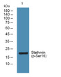 Western blot analysis of lysates from U2OS cells, primary antibody was diluted at 1:1000, 4°C overnight STJ194748