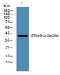 Western blot analysis of lysates from HCT116 cells, primary antibody was diluted at 1:1000, 4°C over night