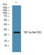 Western blot analysis of lysates from SW480 cells, primary antibody was diluted at 1:1000, 4°C over night