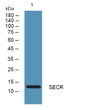 Western blot analysis of lysates from HCT116 cells, primary antibody was diluted at 1:1000, 4° overnight STJ194765