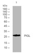 Western blot analysis of lysates from HepG2 cells, primary antibody was diluted at 1:1000, 4° overnight STJ194824