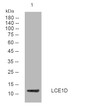 Western blot analysis of lysates from HepG2 cells, primary antibody was diluted at 1:1000, 4°C overnight STJ194833