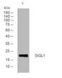 Western blot analysis of lysates from U2OS cells, primary antibody was diluted at 1:1000, 4° overnight STJ194855
