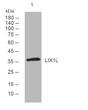 Western blot analysis of lysates from HepG2 cells, primary antibody was diluted at 1:1000, 4° overnight STJ194868