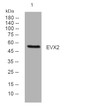 Western blot analysis of lysates from MCF-7 cells, primary antibody was diluted at 1:1000, 4°C over night Western blot analysis of lysates from MCF-7 cells, primary antibody was diluted at 1:1000, 4°C over night