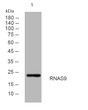 Western blot analysis of lysates from HepG2 cells, primary antibody was diluted at 1:1000, 4°C overnight STJ194946