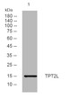 Western blot analysis of lysates from HpeG2 cells, primary antibody was diluted at 1:1000, 4°C over night