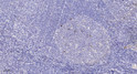 Immunohistochemical analysis of paraffin-embedded human tonsil. 1, Antibody was diluted at 1:200 (4° overnight). 2, STJ194978