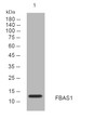 Western blot analysis of lysates from MCF-7 cells, primary antibody was diluted at 1:1000, 4°C over night