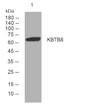 Western blot analysis of lysates from MDA-MB cells, primary antibody was diluted at 1:1000, 4°C overnight STJ195018