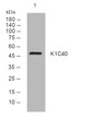 Western blot analysis of lysates from HeLa cells, primary antibody was diluted at 1:1000, 4°C overnight STJ195023