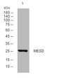 Western blot analysis of lysates from MCF-7 cells, primary antibody was diluted at 1:1000, 4°C overnight STJ195088