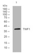 Western blot analysis of lysates from MCF-7 cells, primary antibody was diluted at 1:1000, 4°C over night