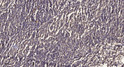 Immunohistochemical analysis of paraffin-embedded human meningioma. 1, Antibody was diluted at 1:200 (4° overnight). 2, STJ195111